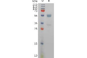 Human CD94 Protein, hFc Tag on SDS-PAGE under reducing condition. (CD94 Protein (Fc Tag))