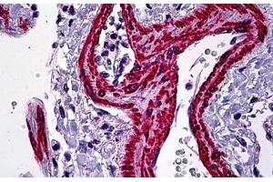 Human Lung, Vessels: Formalin-Fixed, Paraffin-Embedded (FFPE) (Smooth Muscle Actin antibody  (N-Term))