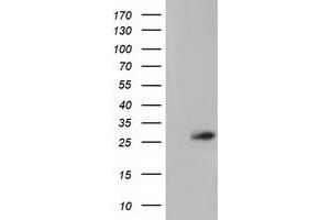 HEK293T cells were transfected with the pCMV6-ENTRY control (Left lane) or pCMV6-ENTRY OTUB2 (Right lane) cDNA for 48 hrs and lysed. (OTUB2 antibody)