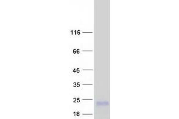 MT1A Protein (Myc-DYKDDDDK Tag)