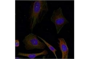 Image no. 3 for anti-Growth Associated Protein 43 (GAP43) (Ser41) antibody (ABIN197546) (GAP43 antibody  (Ser41))