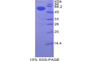 SDS-PAGE analysis of Human Btk Protein. (BTK Protein)