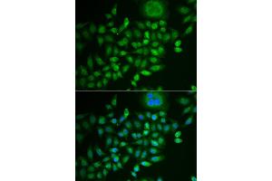 Immunofluorescence analysis of MCF-7 cell using SCG2 antibody. (SCG2 antibody)