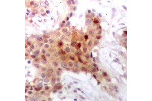 Immunohistochemistry (IHC) image for anti-Small Nuclear Ribonucleoprotein Polypeptide N (SNRPN) antibody (ABIN7308354) (SNRPN antibody)