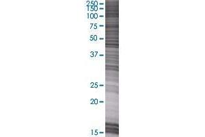 ZNF24 transfected lysate. (ZNF24 293T Cell Transient Overexpression Lysate(Denatured))