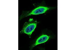 Immunofluorescence (IF) image for anti-beta-2-Microglobulin (B2M) (AA 21-100) antibody (ABIN1724934)