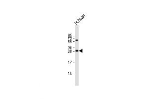 Western Blot at 1:2000 dilution + human heart lysate Lysates/proteins at 20 ug per lane. (Adenylate Kinase 2 antibody  (C-Term))