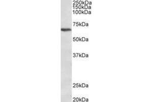 Image no. 1 for anti-Calcium Channel, Voltage-Dependent, beta 2 Subunit (CACNB2) (AA 565-579) antibody (ABIN1100373) (CACNB2 antibody  (AA 565-579))