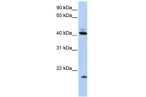 Ubiquitin D antibody used at 1 ug/ml to detect target protein. (UBD antibody  (N-Term))