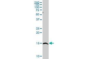 SH2D1A MaxPab rabbit polyclonal antibody. (SH2D1A antibody  (AA 1-128))