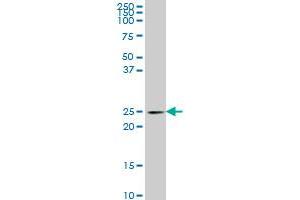 PCMT1 monoclonal antibody (M01), clone 4G9 Western Blot analysis of PCMT1 expression in PC-12 . (PCMT1 antibody  (AA 1-228))