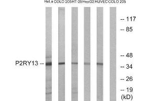 Western Blotting (WB) image for anti-Purinergic Receptor P2Y, G-Protein Coupled, 13 (P2RY13) (Internal Region) antibody (ABIN1853313) (Purinergic Receptor P2Y, G-Protein Coupled, 13 (P2RY13) (Internal Region) antibody)