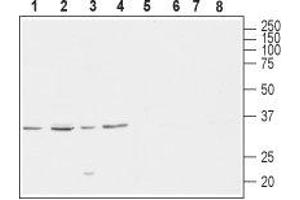 Western blot analysis of rat brain (lanes 1 and 5), mouse brain (lanes 2 and 6), human SH-SY5Y brain neuroblastoma (lanes 3 and 7) and  rat PC12 pheochromocytoma adrenal gland (lanes 4 and 8) lysates: - 1-4. (CACNG4 antibody  (C-Term, Intracellular))