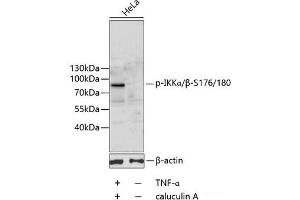 Western blot analysis of extracts of HeLa cells using Phospho-IKKα/β(S176/180) Polyclonal Antibody. (IKK-alpha /IKK-beta antibody  (pSer176, pSer180))