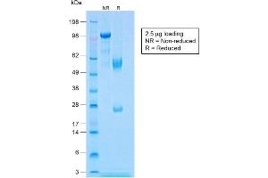 SDS-PAGE Analysis of Purified Calponin Rabbit Recombinant Monoclonal Antibody (CNN1/1408R). (Recombinant CNN1 antibody)