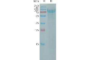 PODXL2 Protein (AA 33-499) (His tag)