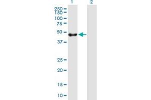 Lane 1: DOC2B transfected lysate ( 45. (DOC2B 293T Cell Transient Overexpression Lysate(Denatured))