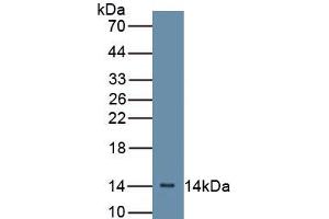 Western Blotting (WB) image for Complement Factor B (CFB) ELISA Kit (ABIN6720575)