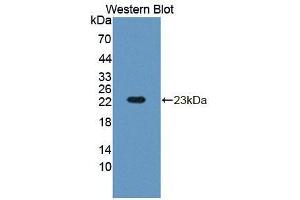 Figure. (RGS10 antibody  (AA 16-181))