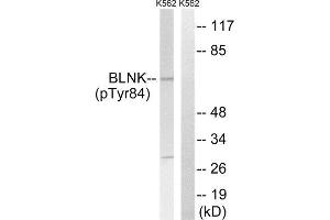 Western Blotting (WB) image for anti-B-Cell Linker (BLNK) (pTyr84) antibody (ABIN1847671) (B-Cell Linker antibody  (pTyr84))