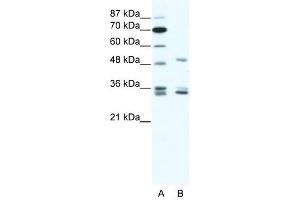 Western Blot showing ZNF488 antibody used at a concentration of 1-2 ug/ml to detect its target protein. (ZNF488 antibody  (C-Term))