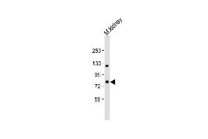 ADAM21 antibody  (C-Term)