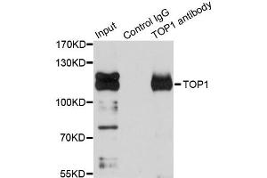 Immunoprecipitation analysis of 150ug extracts of Jurkat cells using 3ug TOP1 antibody (ABIN6290286). (Topoisomerase I antibody)