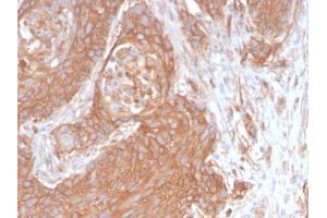 Immunohistochemistry (IHC) image for anti-Spectrin, Beta, Non-erythrocytic 2 (SPTBN2) (AA 356-475) antibody (ABIN6940656)