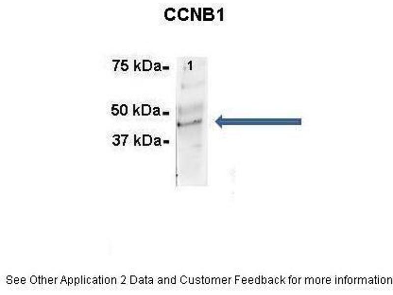 Cyclin B1 Antibody  Cell Signaling Technology