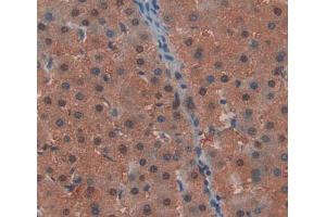 Used in DAB staining on fromalin fixed paraffin- embedded Kidney tissue (CHP antibody  (AA 2-195))
