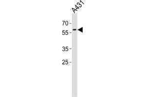 Western Blotting (WB) image for anti-Paired Box 3 (PAX3) antibody (ABIN3001734) (Paired Box 3 antibody)