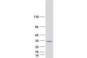 Validation with Western Blot (RAB34 Protein (Transcript Variant 1) (Myc-DYKDDDDK Tag))