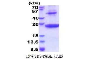 SDS-PAGE (SDS) image for Major Histocompatibility Complex, Class II, DR beta 1 (HLA-DRB1) (AA 30-227) protein (His tag) (ABIN5853579) (HLA-DRB1 Protein (AA 30-227) (His tag))