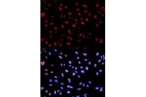 Immunofluorescence (IF) image for anti-Myocyte Enhancer Factor 2C (MEF2C) (pSer396) antibody (ABIN1870432) (MEF2C antibody  (pSer396))