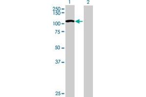 Lane 1: C2CD2L transfected lysate ( 76. (TMEM24 293T Cell Transient Overexpression Lysate(Denatured))