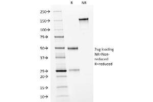 SDS-PAGE Analysis Purified HER-2 Mouse Monoclonal Antibody (HRB2/282). (ErbB2/Her2 antibody  (Extracellular Domain))