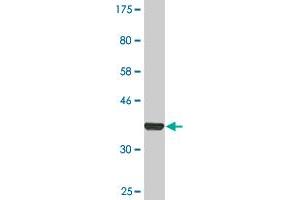 Western Blot detection against Immunogen (36. (Transferrin Receptor antibody  (AA 68-168))