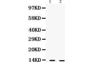 Observed bind size: 13KD (S100A9 antibody  (AA 2-114))