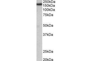 Western Blotting (WB) image for anti-Zinc Finger, CCHC Domain Containing 11 (ZCCHC11) (Internal Region) antibody (ABIN2464955) (ZCCHC11 antibody  (Internal Region))