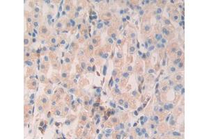 Used in DAB staining on fromalin fixed paraffin- embedded Kidney tissue (MYL6B antibody  (AA 5-199))