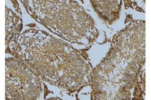 ABIN6275278 at 1/100 staining Mouse testis tissue by IHC-P. (CYB5R3 antibody  (C-Term))
