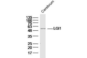 Mouse cerebrum lysates probed with LGI1 Polyclonal Antibody, unconjugated  at 1:300 overnight at 4°C followed by a conjugated secondary antibody at 1:10000 for 90 minutes at 37°C. (LGI1 antibody  (AA 451-557))