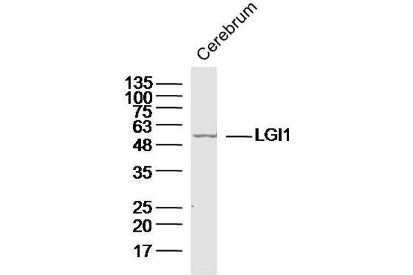 LGI1抗体（AA 451-557）