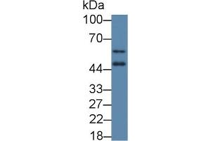 Detection of VDR in Mouse Spinal cord lysate using Polyclonal Antibody to Vitamin D Receptor (VDR) (Vitamin D Receptor antibody  (AA 272-427))