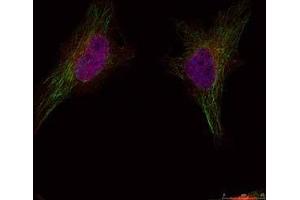 Immunofluorescence staining of methanol-fixed HeLa cells using BRCA1 (Ab-1524) Antibody (E021139, Red) (BRCA1 antibody)