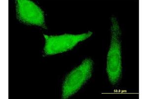 Immunofluorescence of purified MaxPab antibody to PEG10 on HeLa cell. (PEG10 antibody  (AA 1-325))