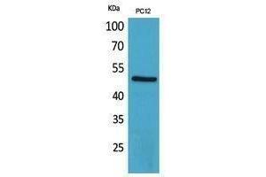 Western Blotting (WB) image for anti-Corticotropin Releasing Hormone Receptor 1 (CRHR1) (Internal Region) antibody (ABIN3181044) (CRHR1 antibody  (Internal Region))