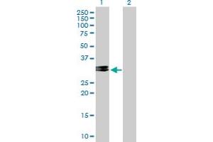 Western Blot analysis of CHMP2A expression in transfected 293T cell line by CHMP2A MaxPab polyclonal antibody. (CHMP2A antibody  (AA 1-222))