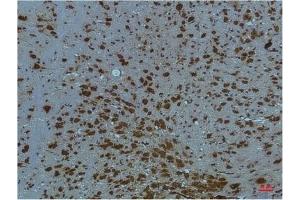 Immunohistochemical analysis of paraffin-embedded Mouse BrainTissue using PI3 Kinase P85 α Mouse mAb diluted at 1:200. (PIK3R1 antibody)