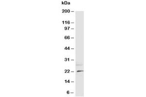 Western blot testing of NGF antibody and rat brain tissue lysate (Nerve Growth Factor antibody  (N-Term))